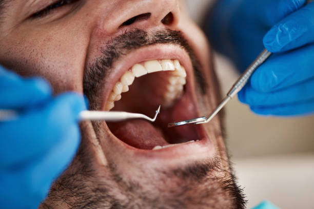 Laser Dentistry in Auburn, WA